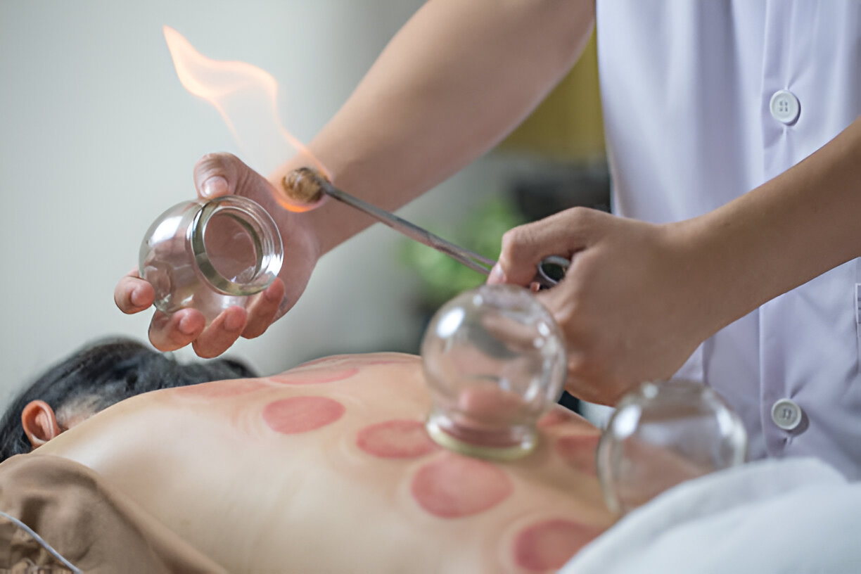 Cupping Massage